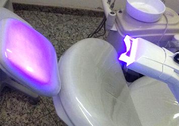 Clareamento Dental em Consultório