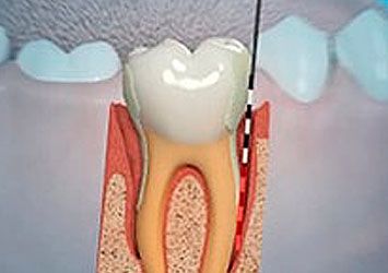 Periodontia
